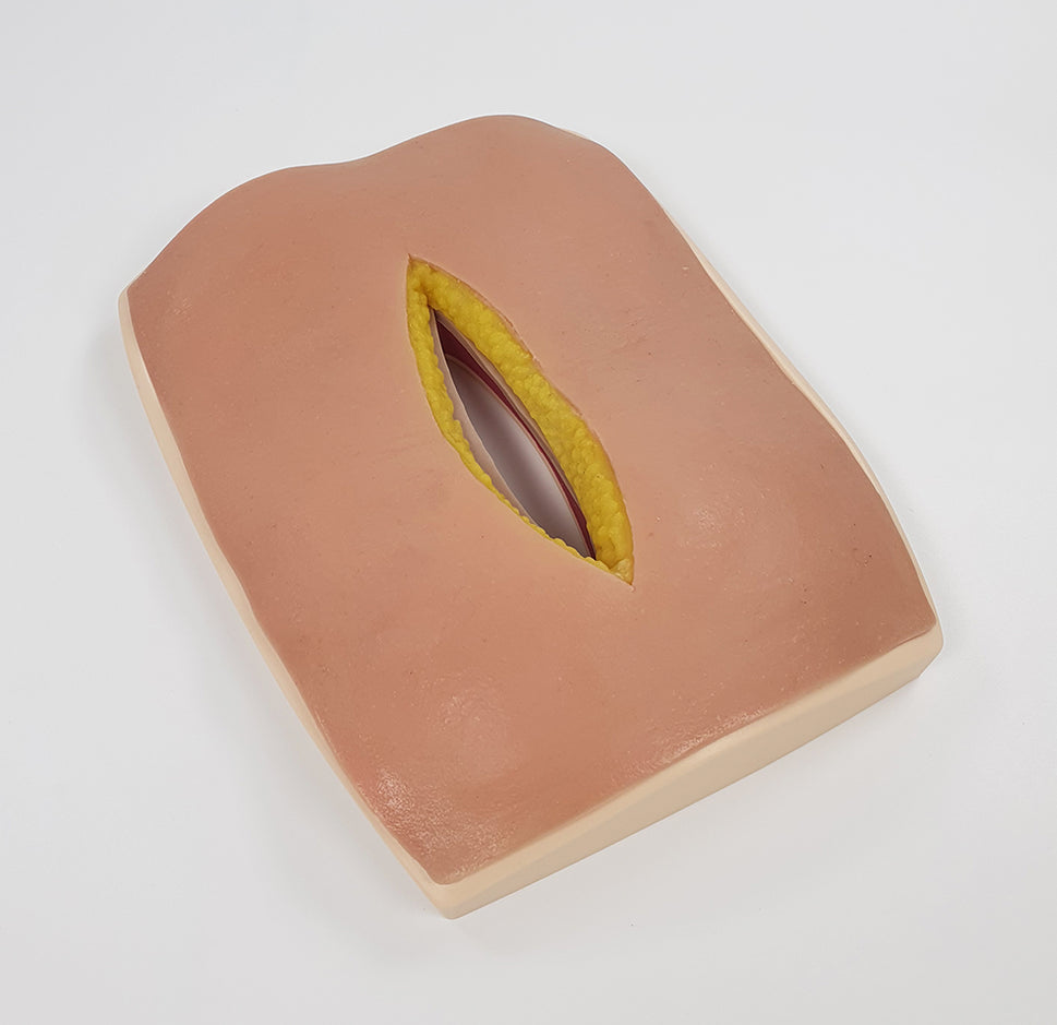 Abdominal Fascia Suture Trainer