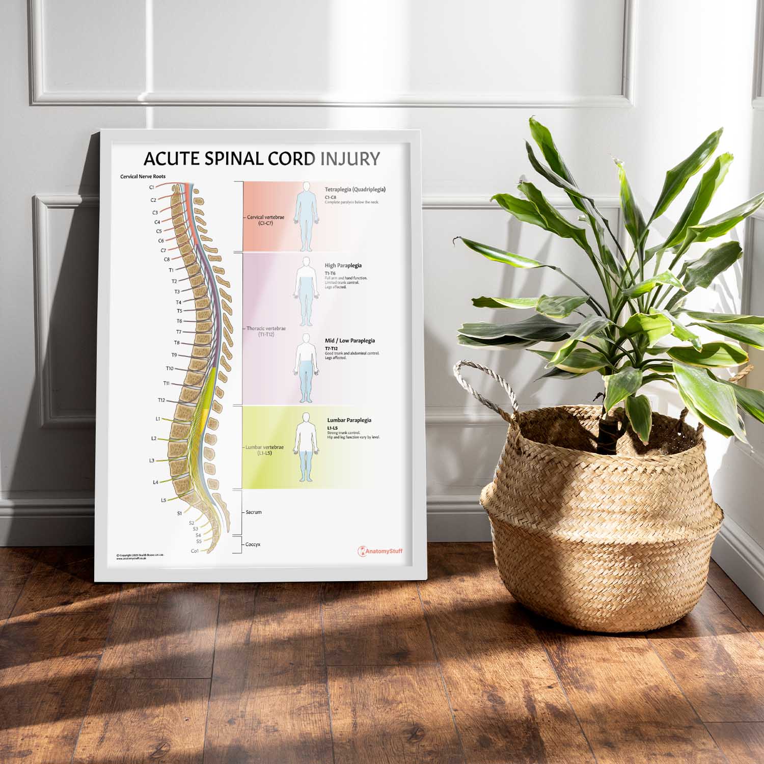 Acute Spinal Cord Injury Chart / Poster