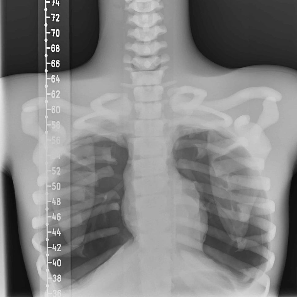 Adult Torso Phantom for X-Ray CT, MRI