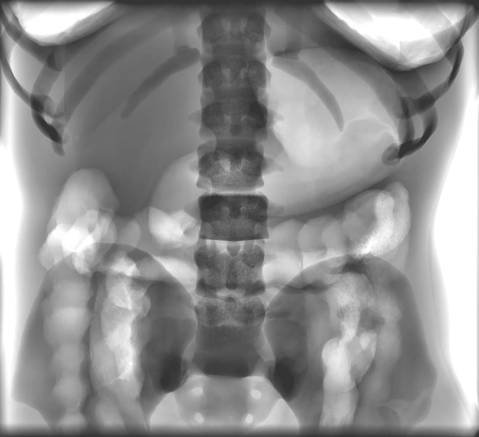 Adult Torso Phantom for X-Ray CT, MRI