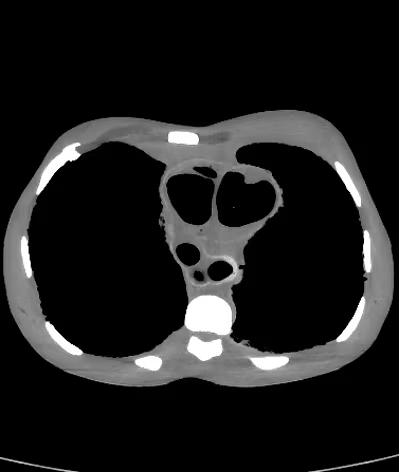 Adult Torso Phantom (Dynamic) for X-Ray CT, MRI