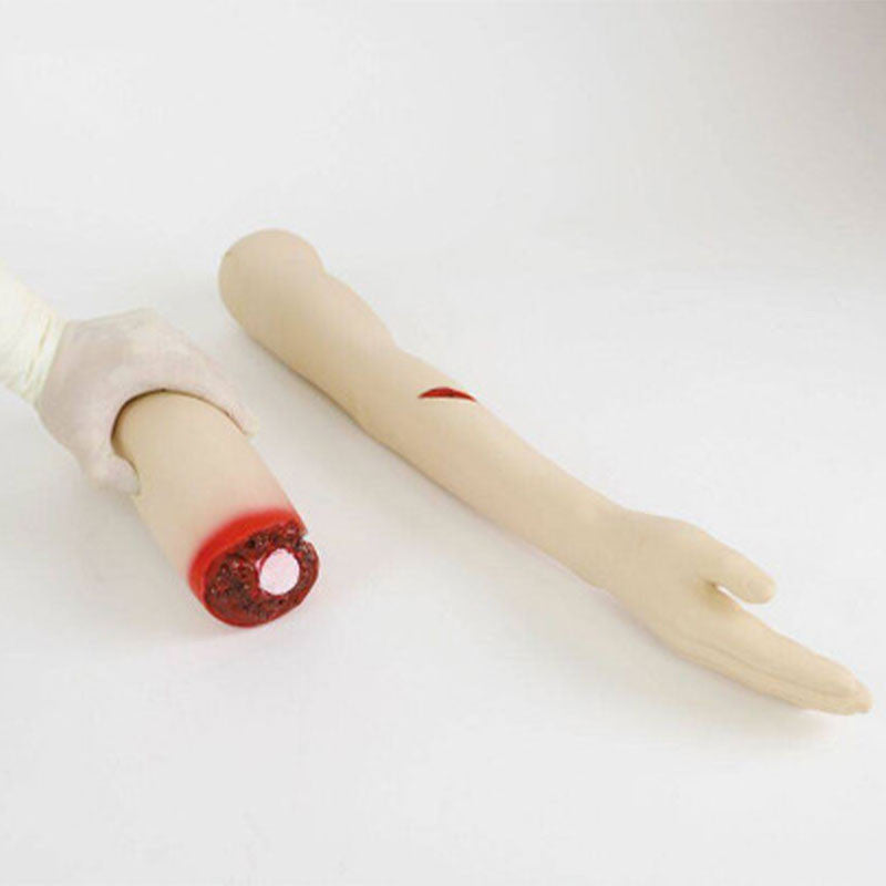 Amputated and Trauma Bleeding Arm