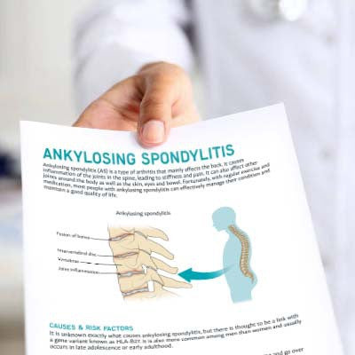 Ankylosing Spondylitis Patient Education Handout (Printable PDF)