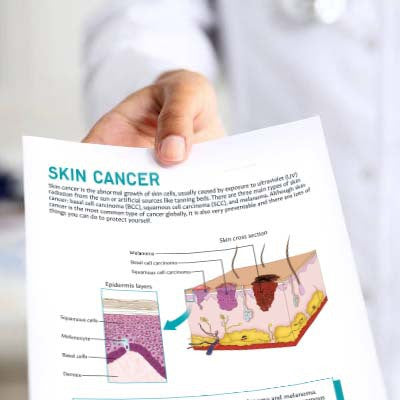 Skin Cancer Patient Education Handout (Printable PDF)