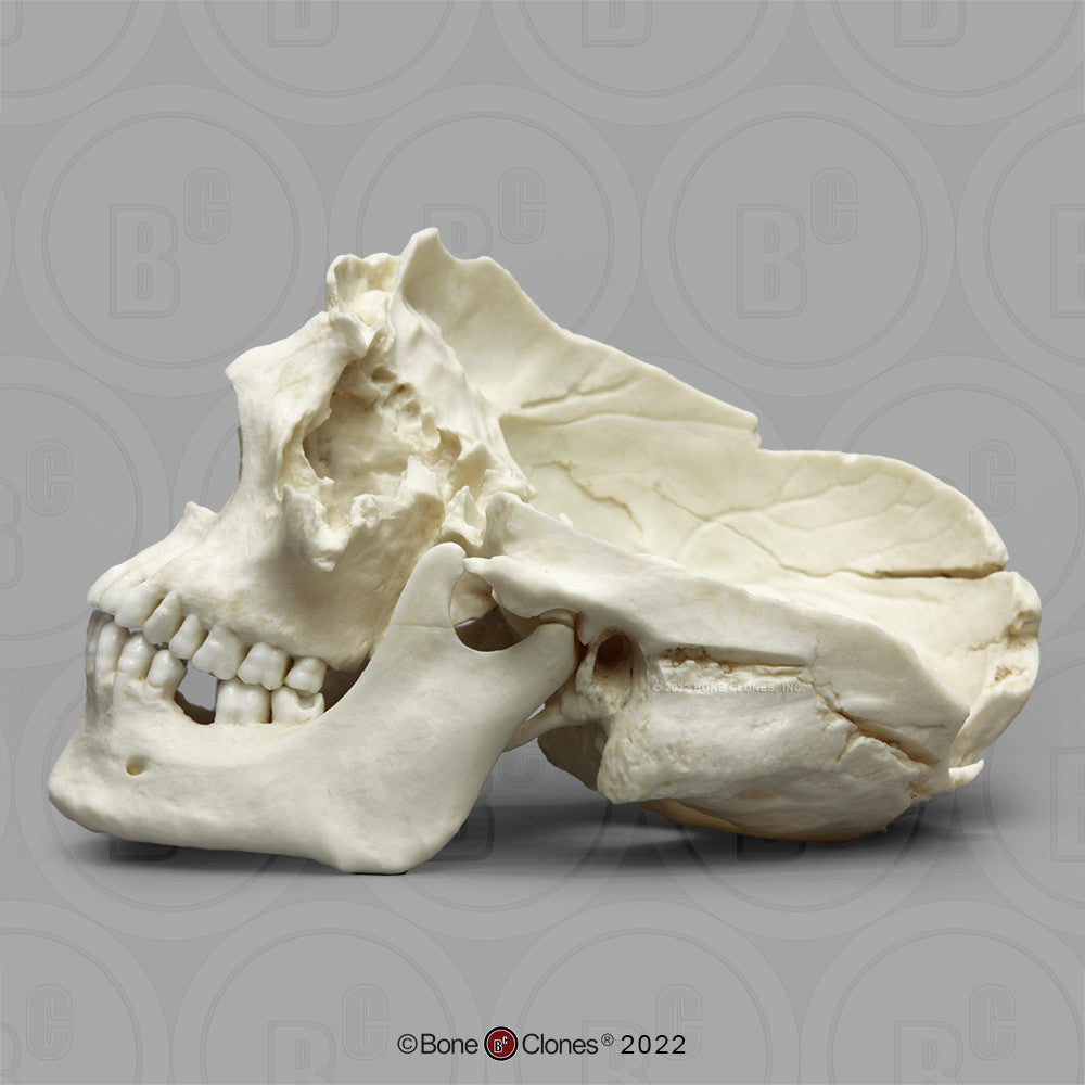 Bone Clones Forensic Trauma Skulls