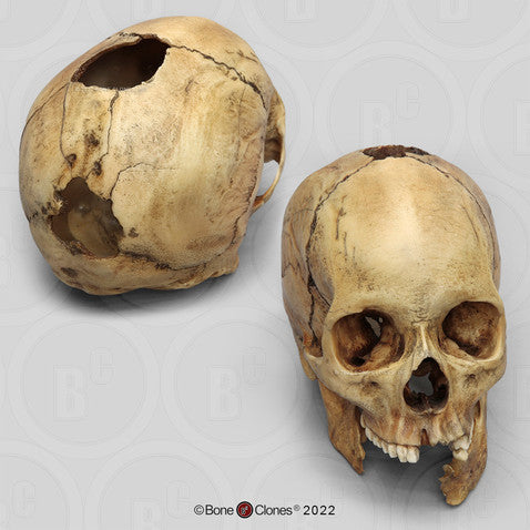 Bone Clones Forensic Trauma Skulls