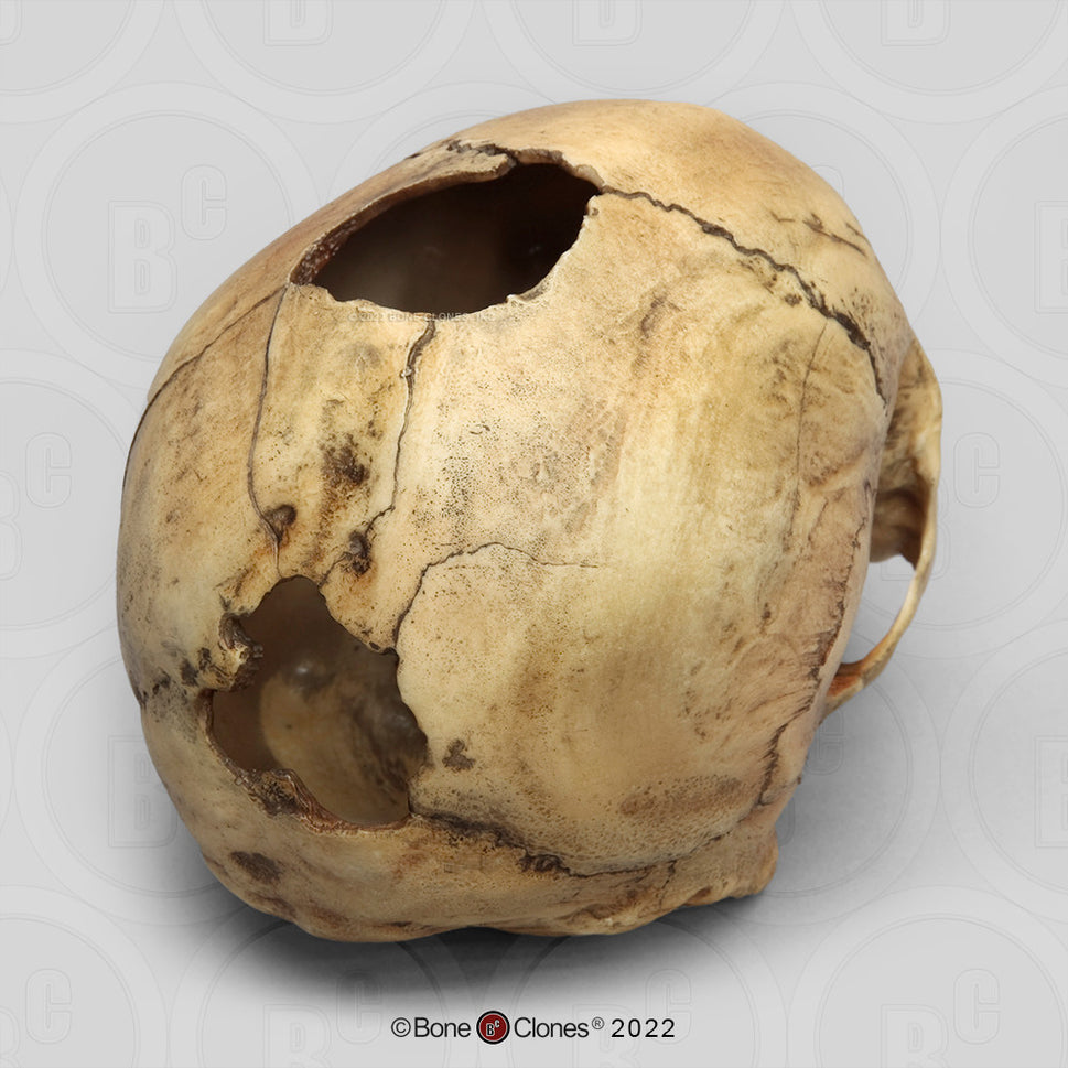 Bone Clones Forensic Trauma Skulls
