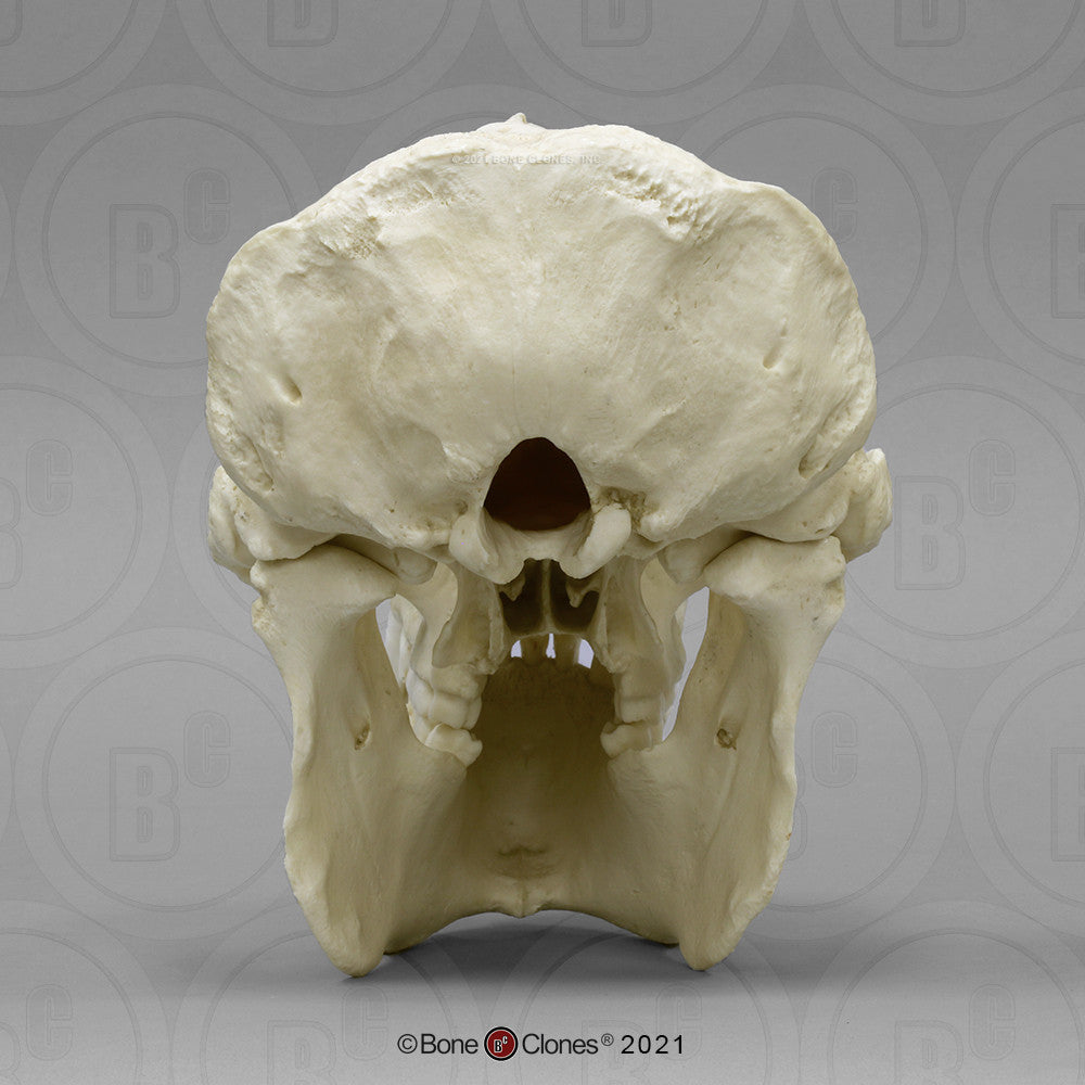 Posterior Aspect of the Male Sumatran Orangutan Skull Model