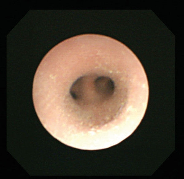 Bronchoscopy Trainer