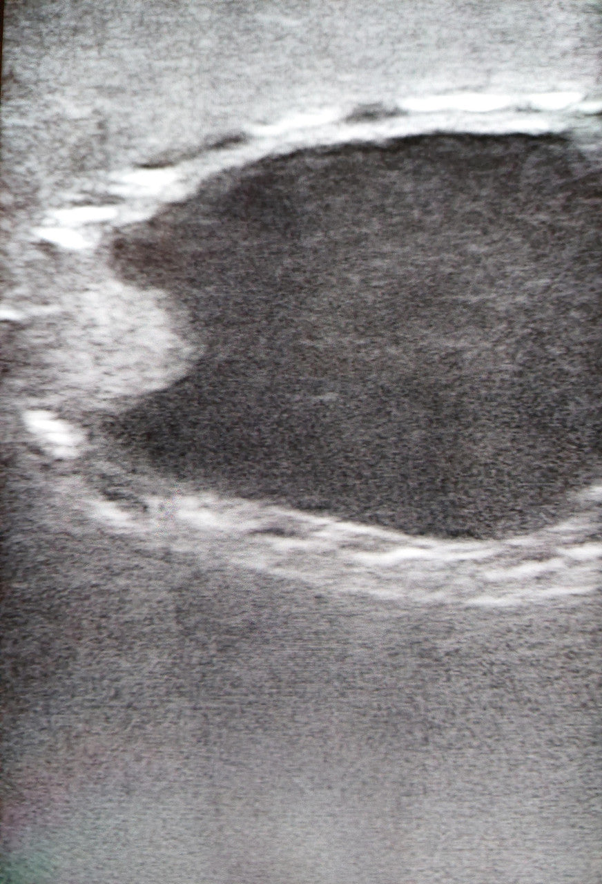 Canine Bladder Ultrasound Simulator