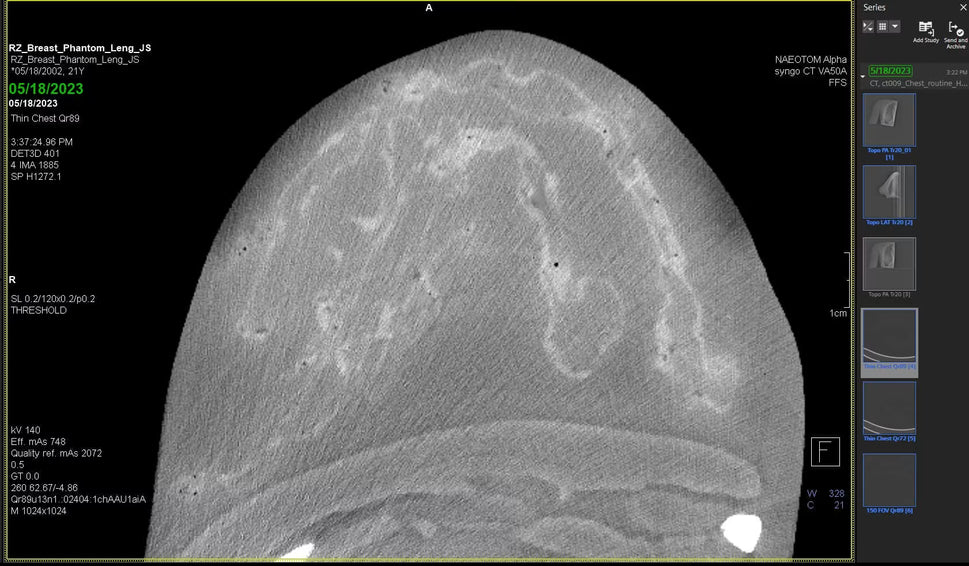 Adult Breast Phantom (Complex) for X-Ray CT, US, MRI