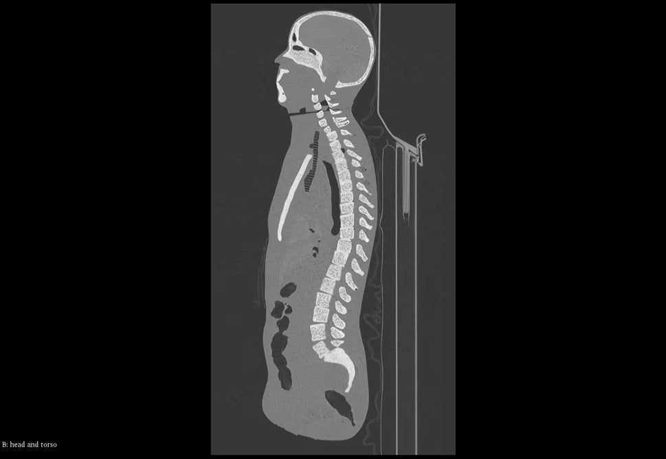Adult Full Body Phantom with Muscles for X-Ray CT, MRI