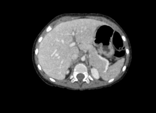 Anatomy Phantom Models for CT, X-Ray, and Radiation Therapy