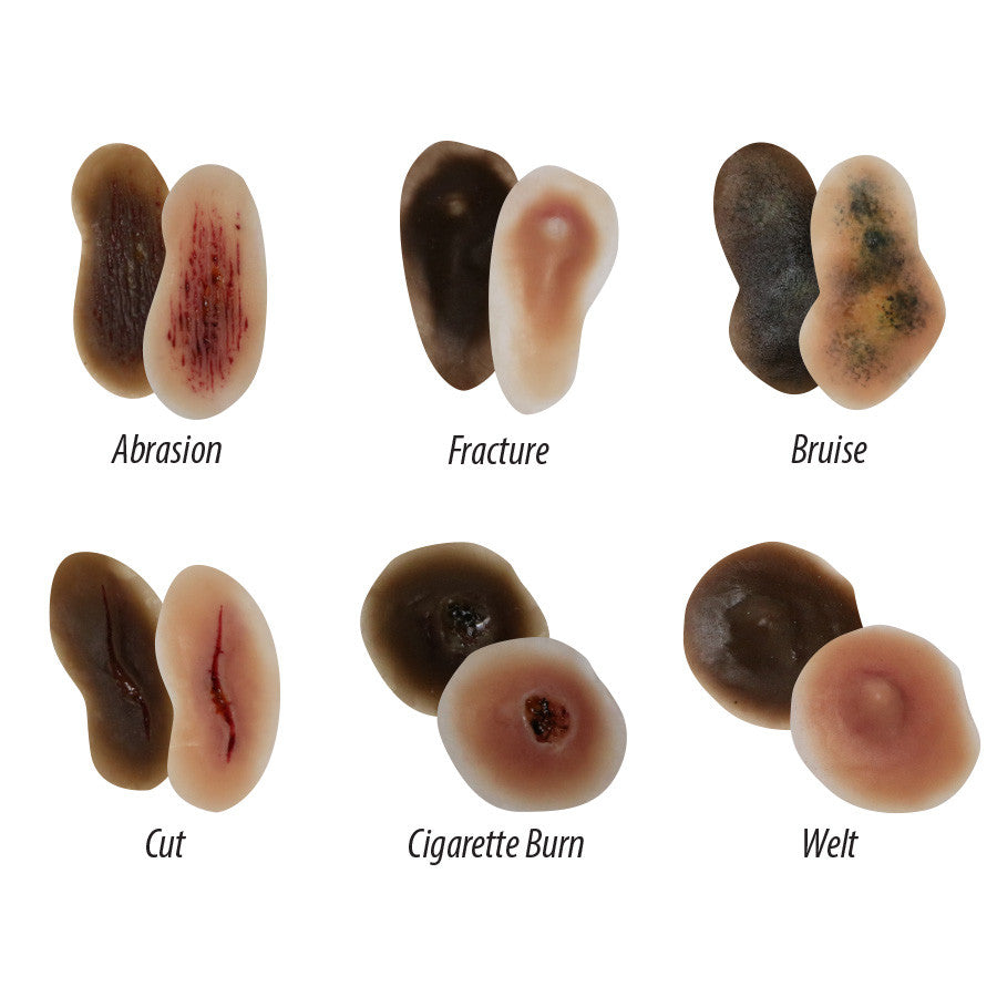 Child Abuse and Neglect Awareness Training Kit