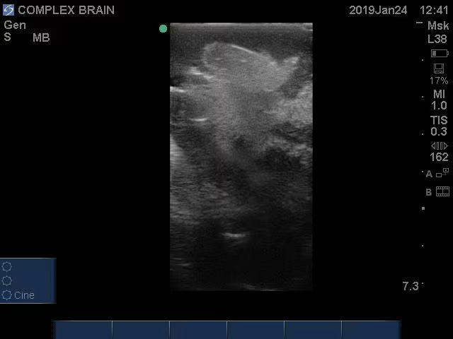 Adult Brain Phantom (Complex) for X-Ray CT, US, MRI