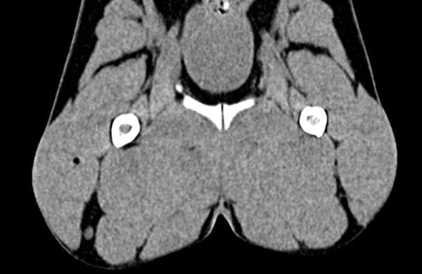 Dog Phantom Models for CT and X-Ray