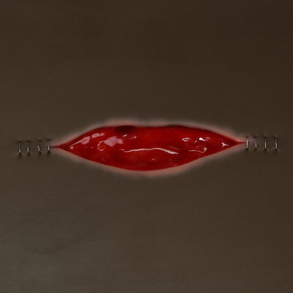 VATA Dehisced Wound Board