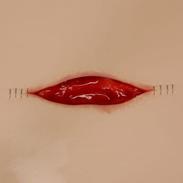 VATA Dehisced Wound Board