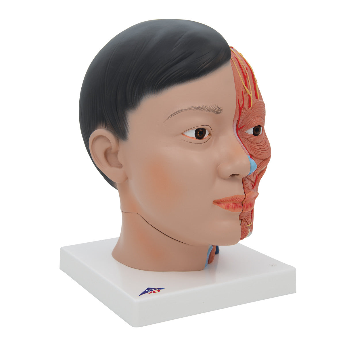 Lateral Anterior showing Asian features