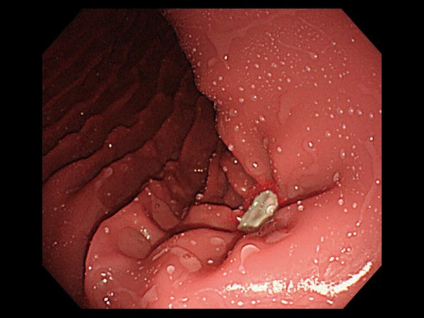 EsophagoGastroDuodenoscopy (EGD) Simulator