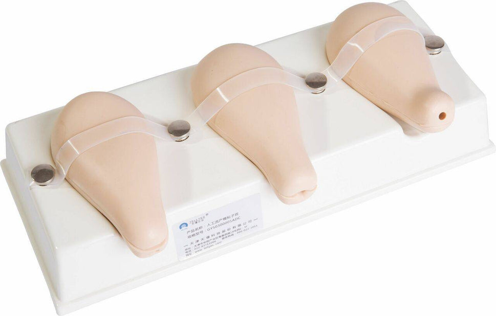 Dilation and Curettage Model