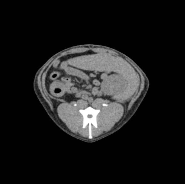 Dog Phantom Models for CT and X-Ray