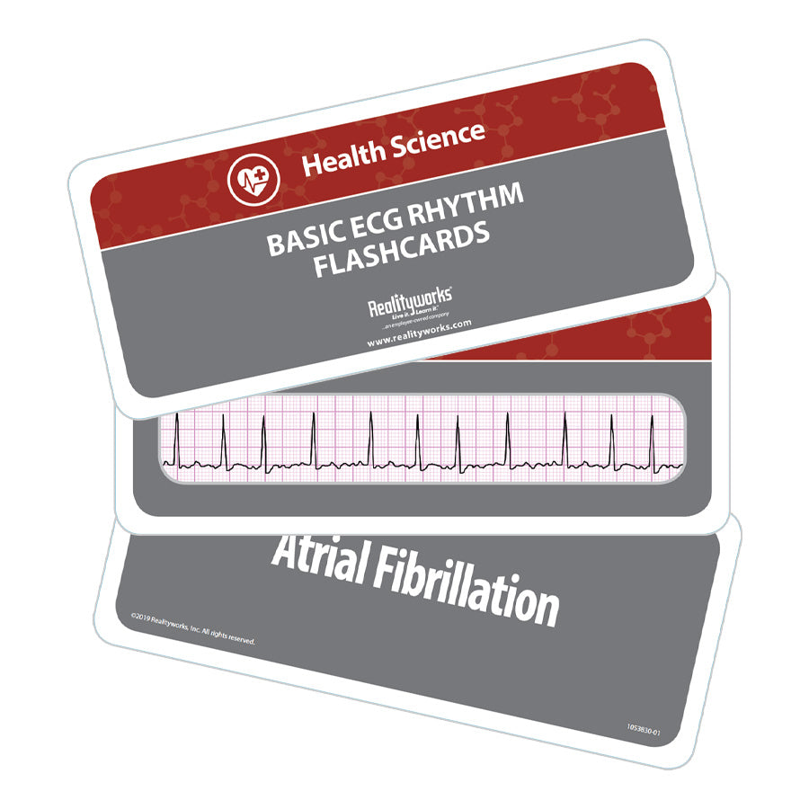 ECG Rhythm Flashcards