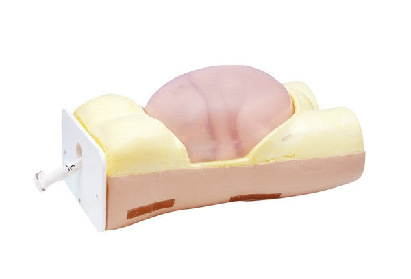 External Cephalic Version Model