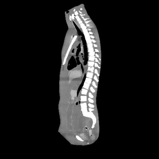 Medical Imaging Phantoms for X-Ray, CT, MRI and Ultrasound