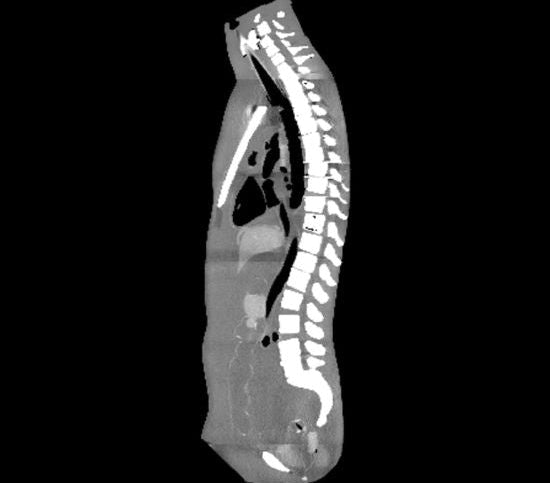 Medical Imaging Phantoms for X-Ray, CT, MRI and Ultrasound