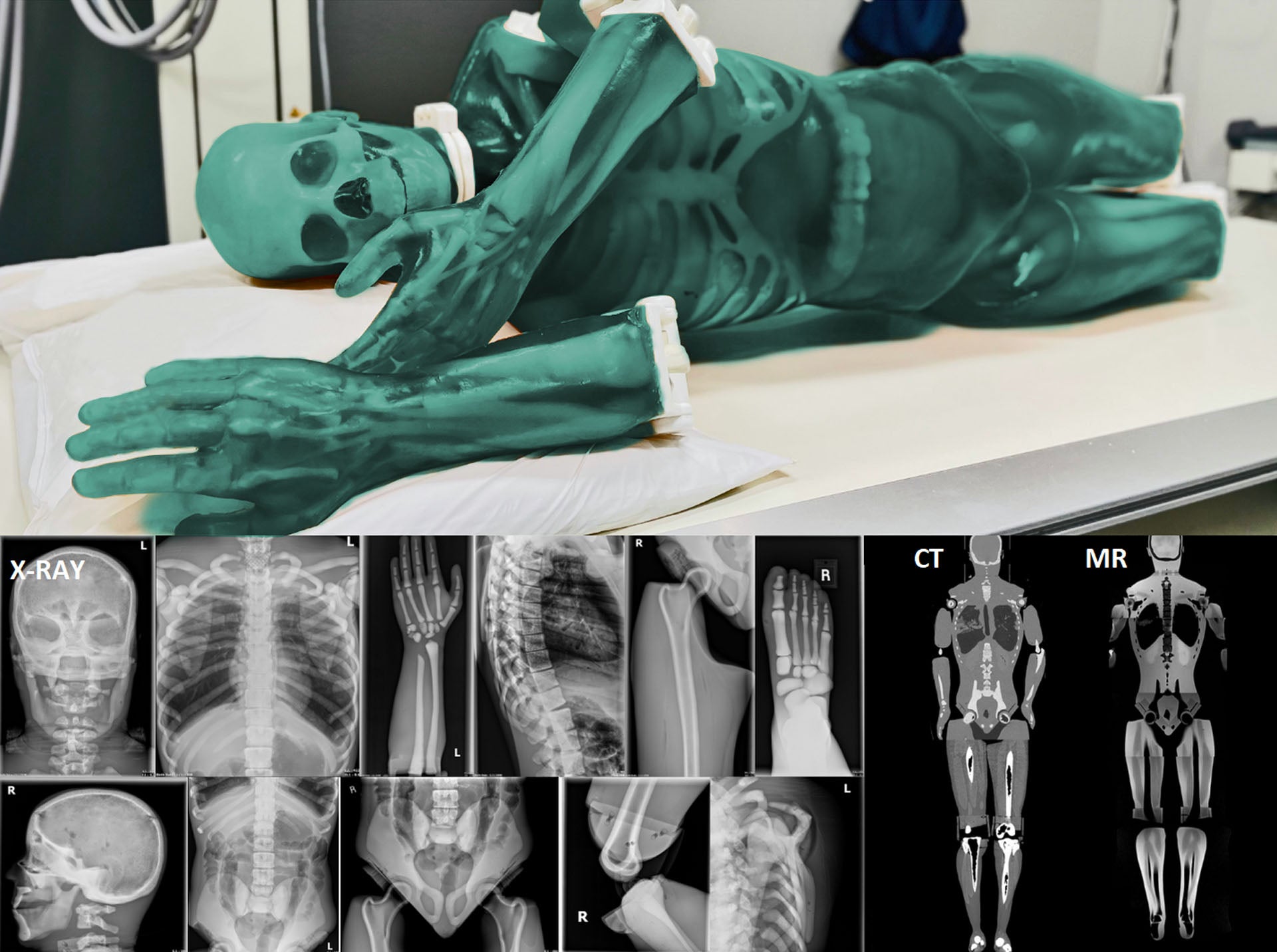 Medical Imaging Phantoms for X-Ray, CT, MRI and Ultrasound