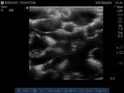Medical Imaging Phantoms for X-Ray, CT, MRI and Ultrasound