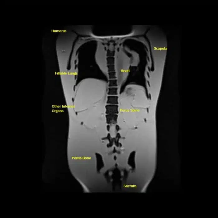 Adult Female Torso Phantom for X-Ray CT, MRI