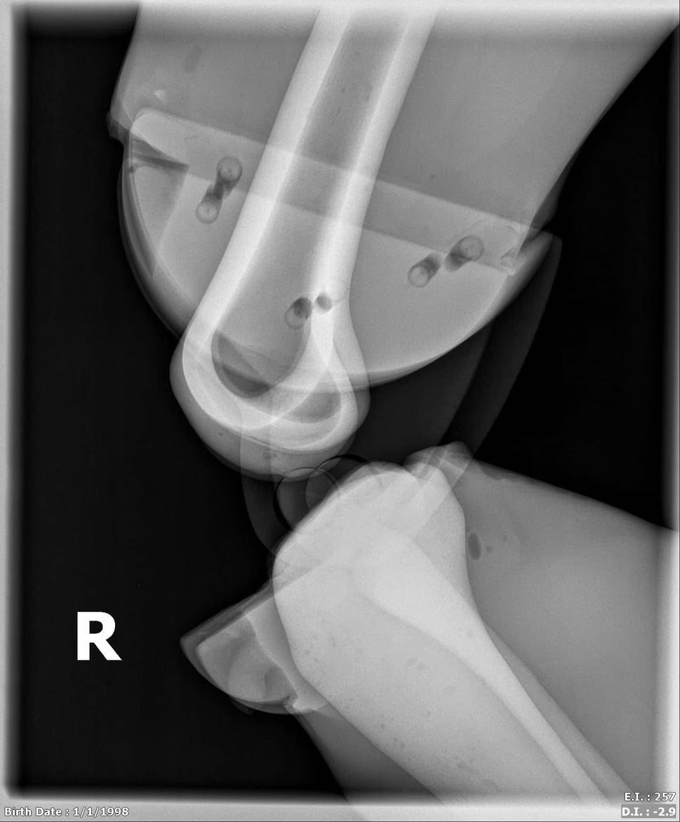 Adult Full Body Phantom with Muscles for X-Ray CT, MRI