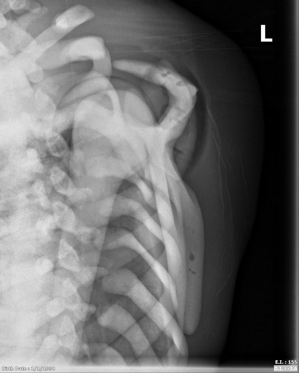 Adult Full Body Phantom with Muscles for X-Ray CT, MRI