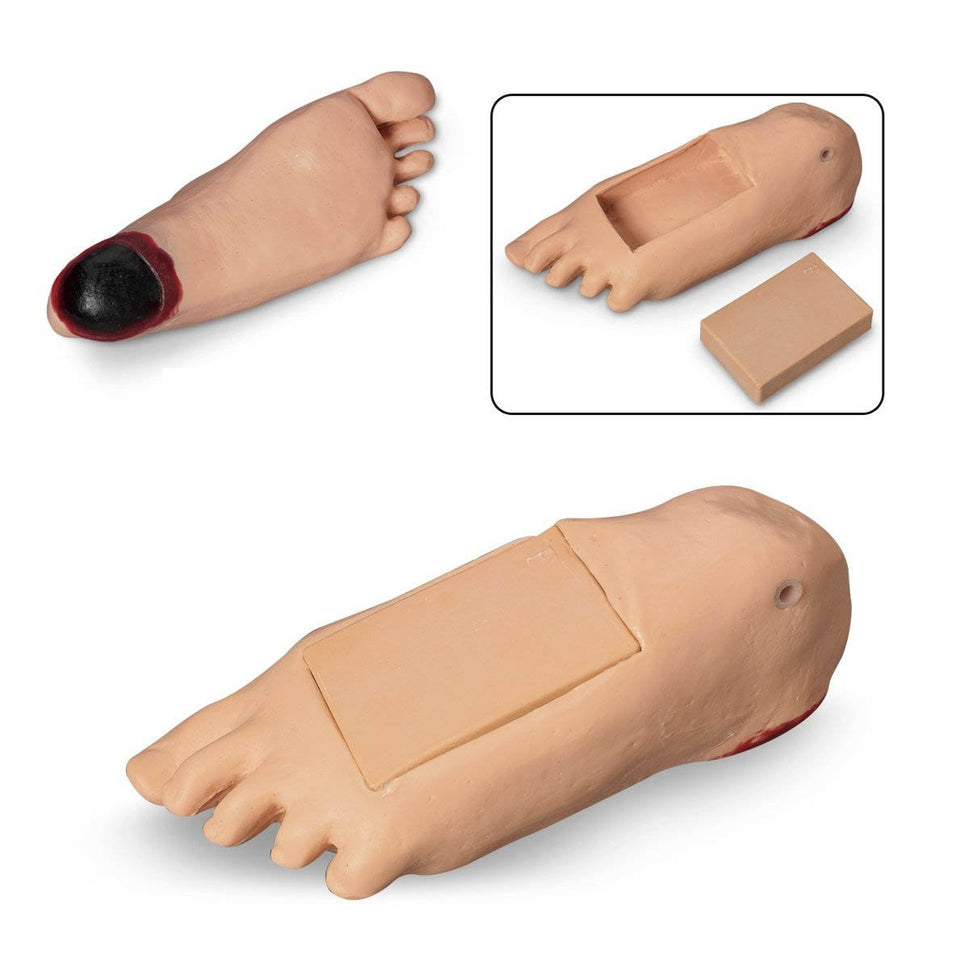 GERi/KERi Optional Oedema Foot