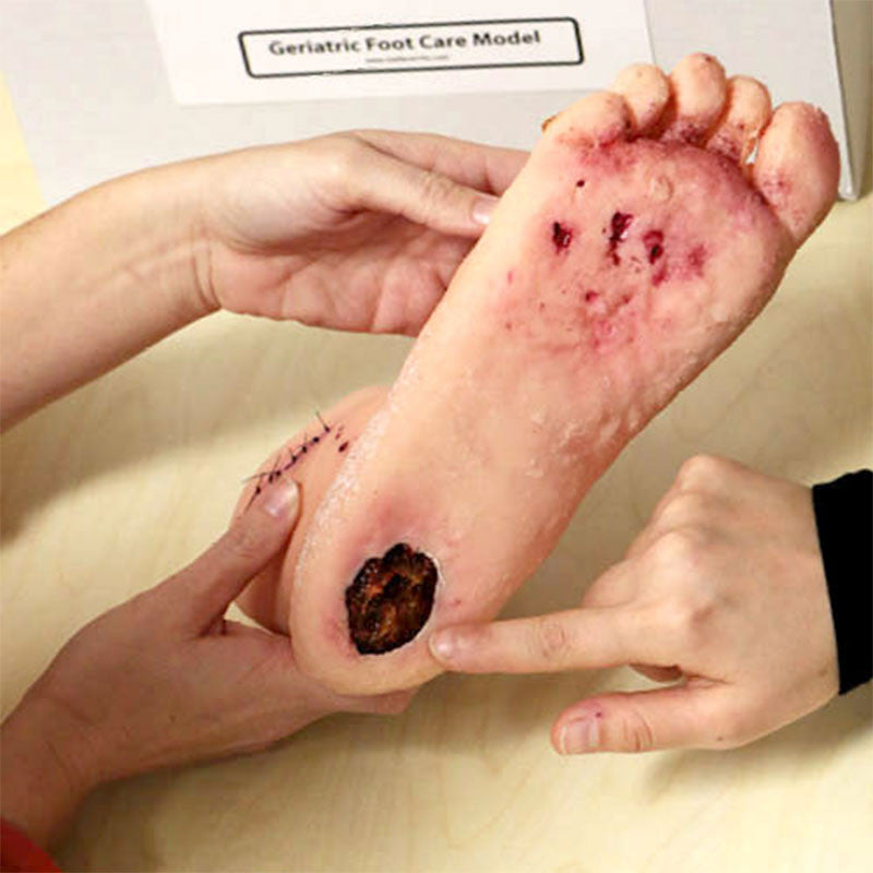 Geriatric Foot Care Model