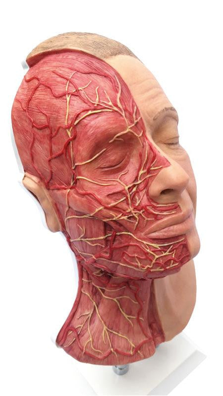 Head for Facial Injections with Muscles, Arteries, and Nerves