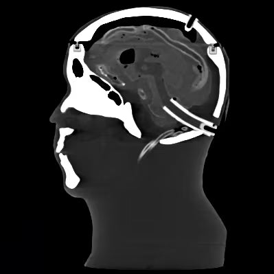 Adult Head Phantom (Dynamic, Advanced) for X-Ray CT, US, MRI