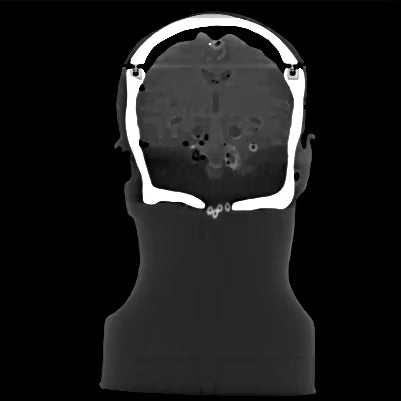 Adult Head Phantom (Dynamic, Advanced) for X-Ray CT, US, MRI