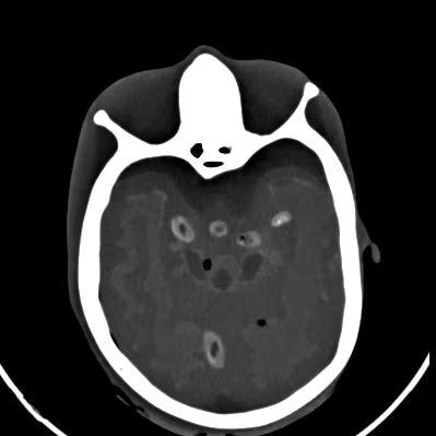 Adult Head Phantom (Dynamic, Advanced) for X-Ray CT, US, MRI