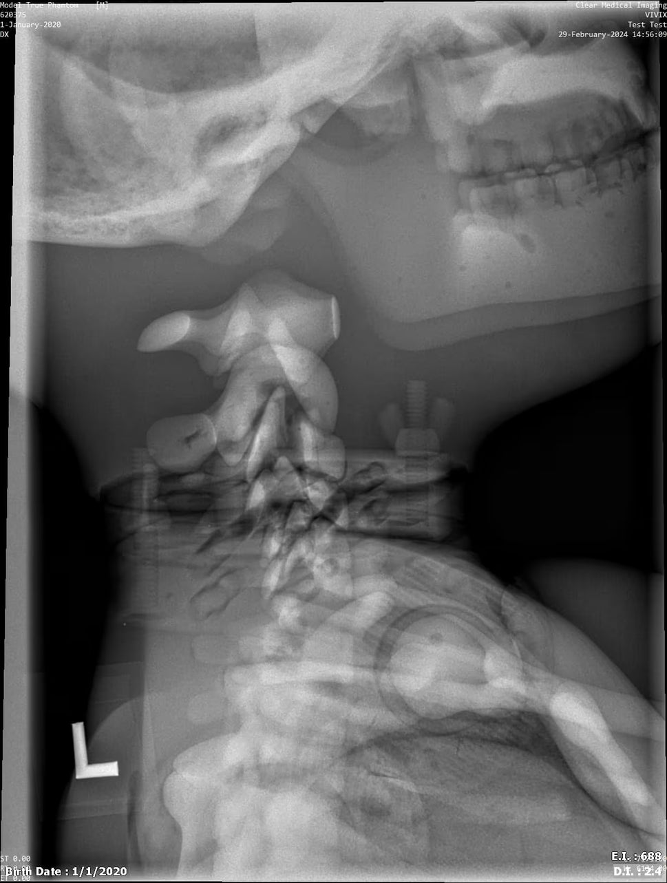 Paediatric Full Body Phantom for X-Ray CT, MRI