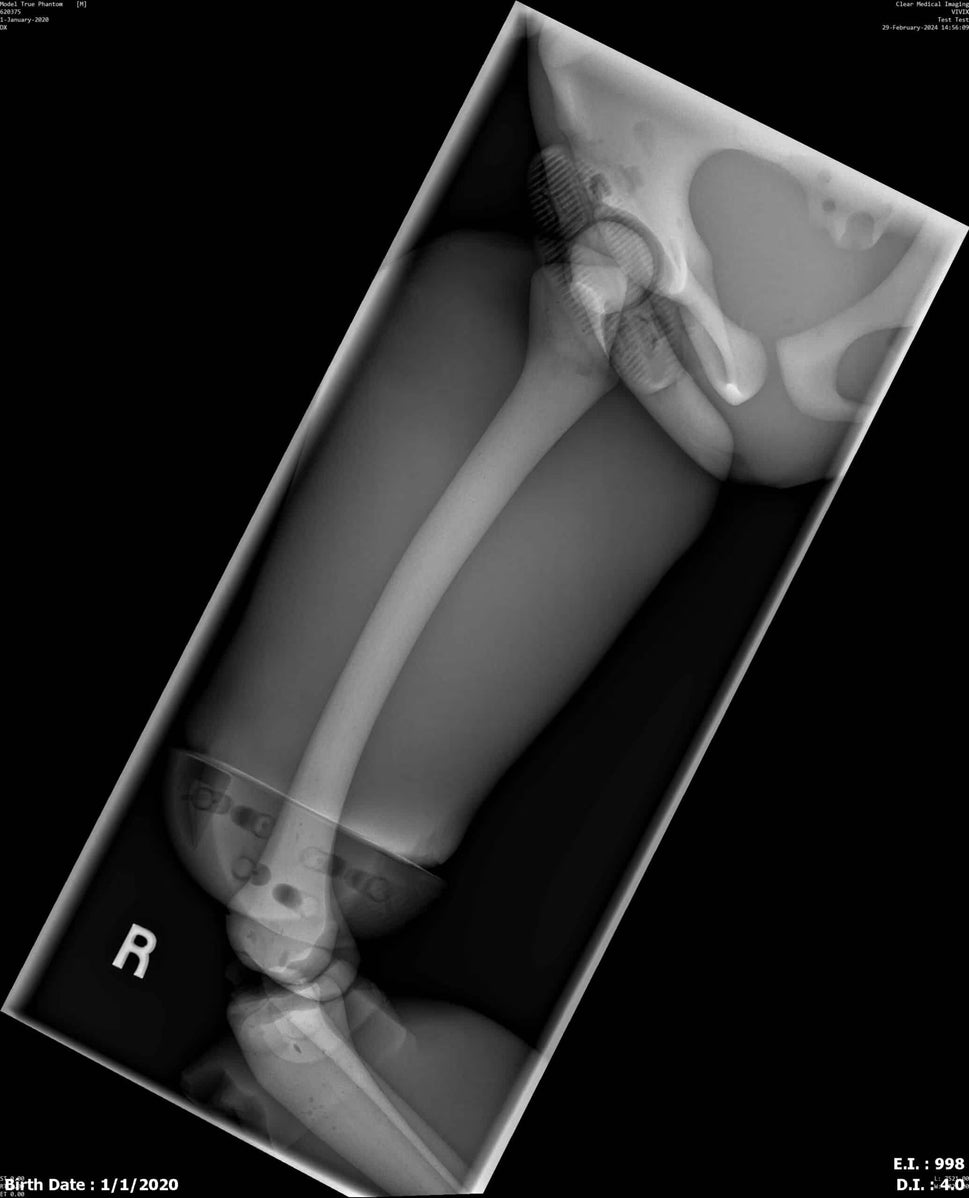 Paediatric Full Body Phantom for X-Ray CT, MRI