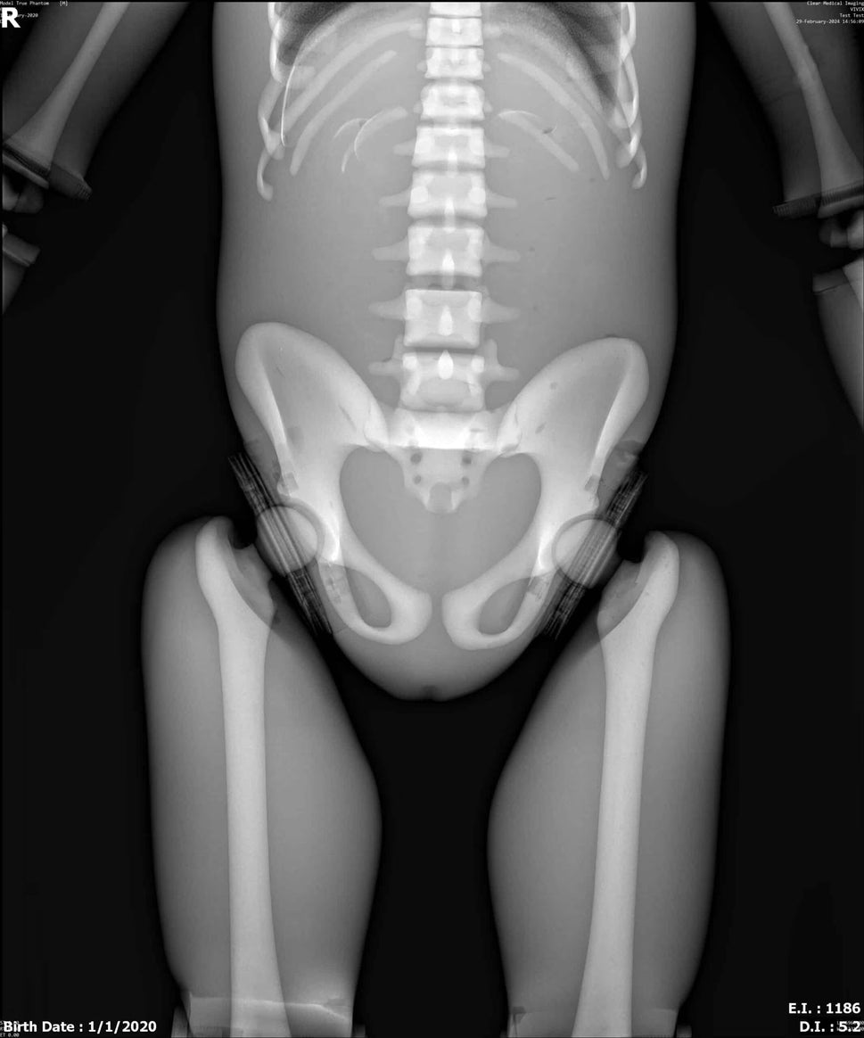Paediatric Full Body Phantom for X-Ray CT, MRI