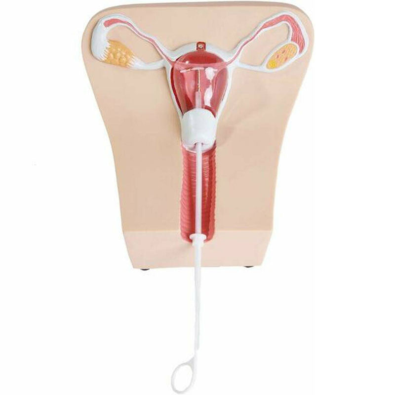 IUD Insertion Model I