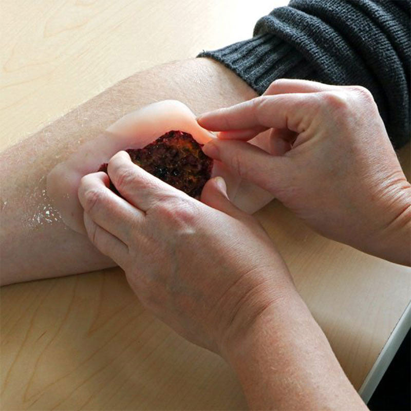 Industrial Burns Kit