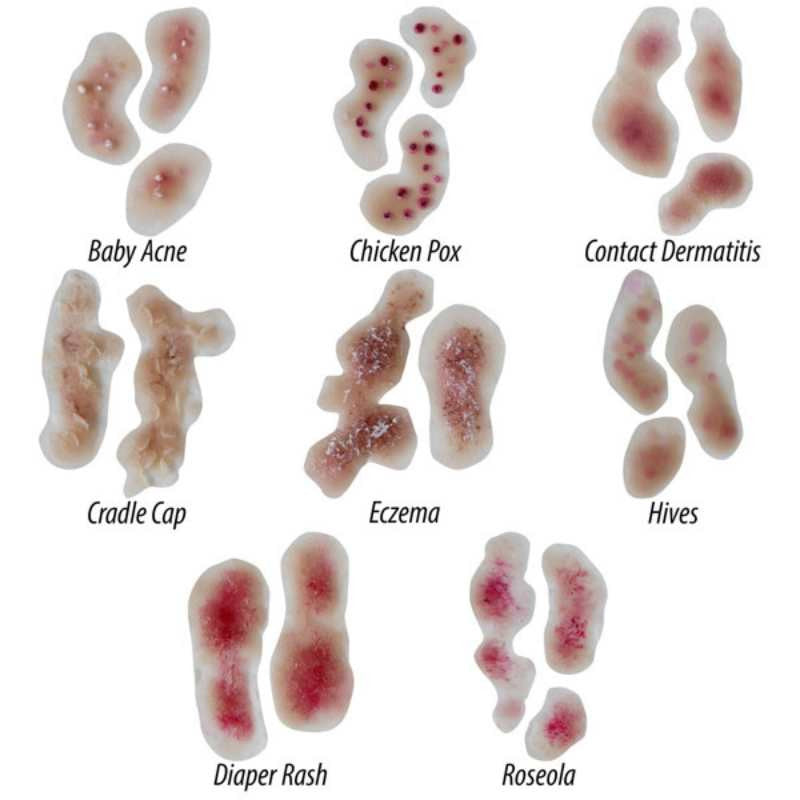 Infant Skin Conditions Kit