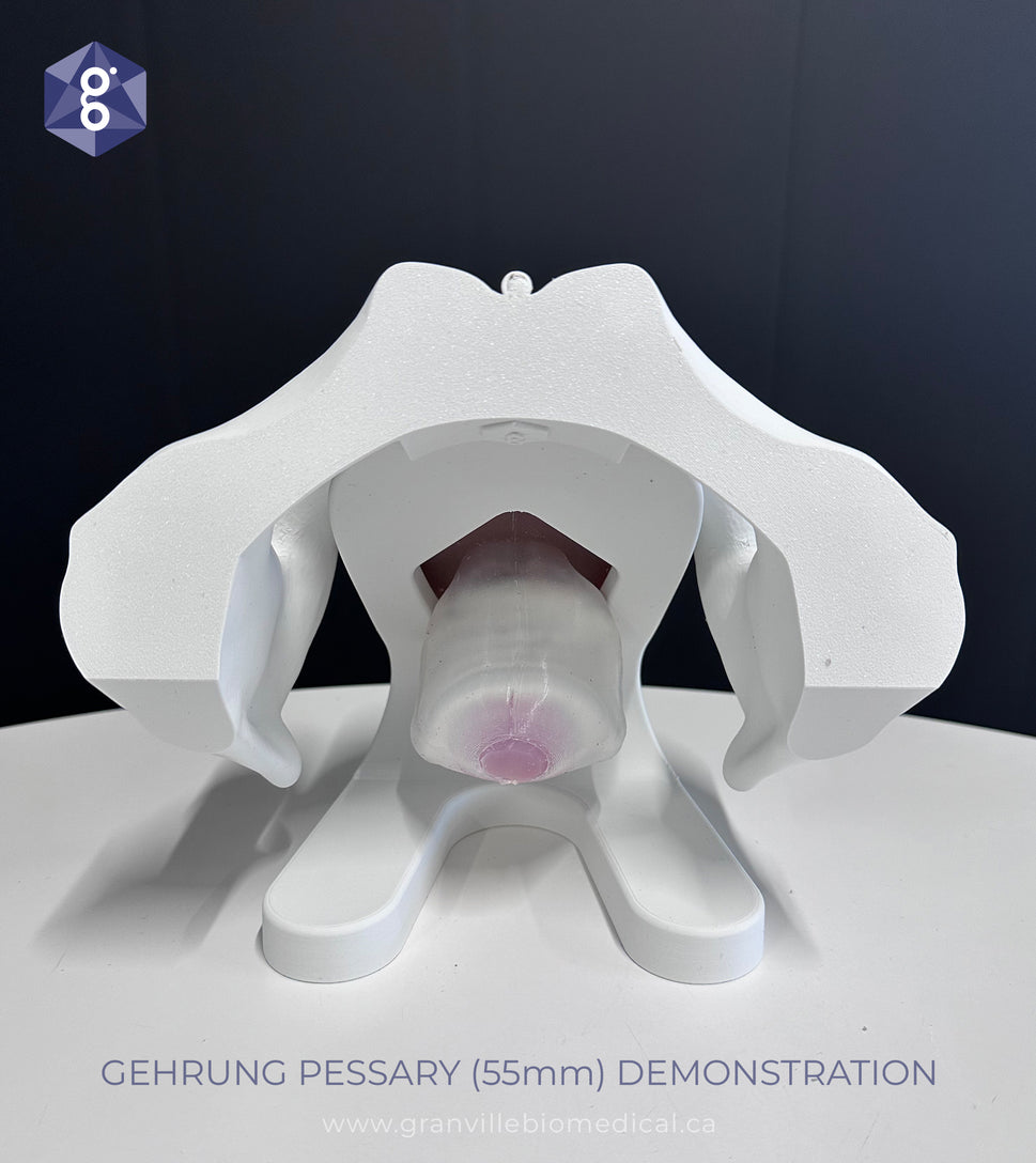 Iris Pessary and Device Demonstration Model