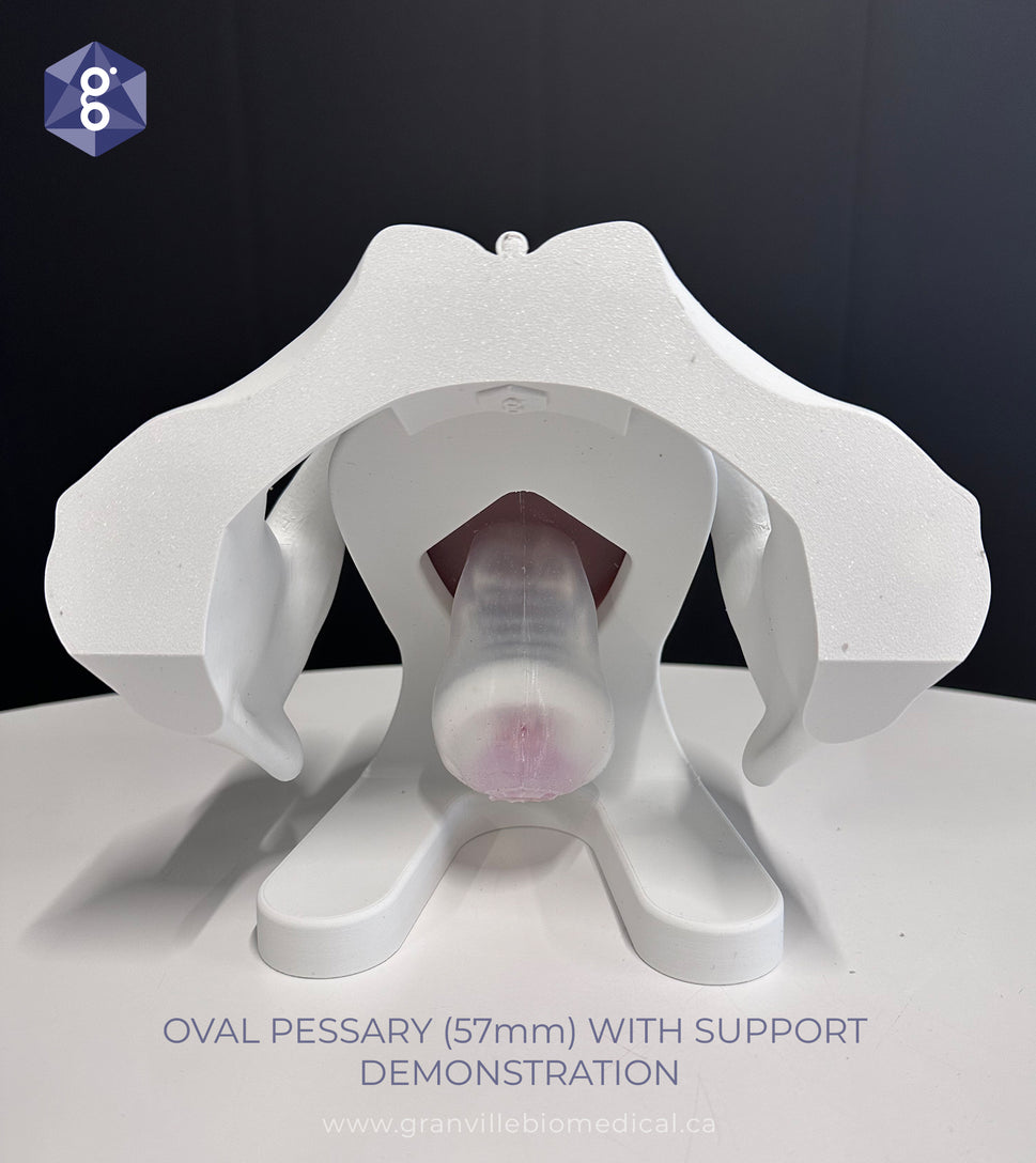 Iris Pessary and Device Demonstration Model