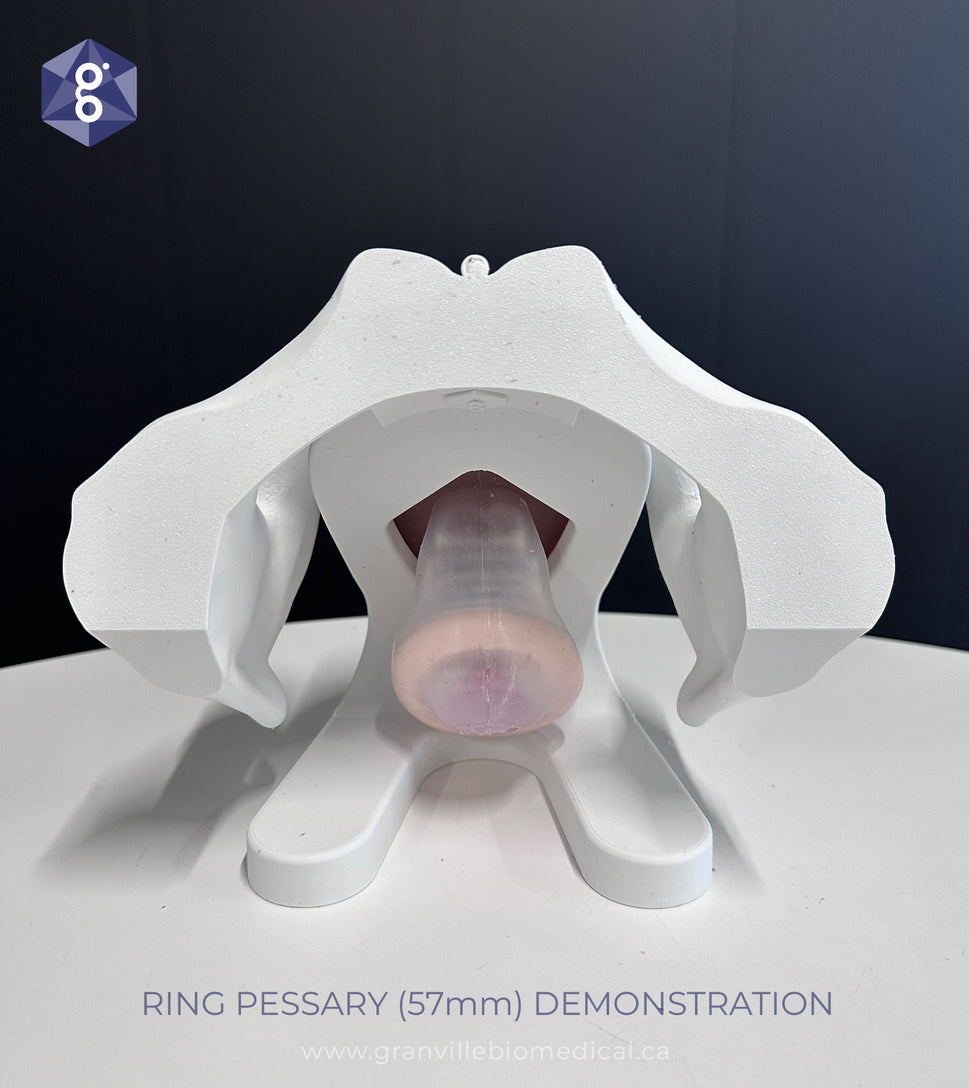 Iris Pessary and Device Demonstration Model